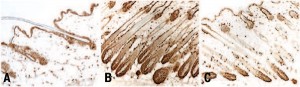 Hair follicles in mouse skin shown in hair cycle stages: resting (A), growing (B) and regressing (C).