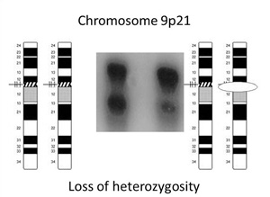 Normally an individual has two alleles—one from the mother and one from the father. Because these have different origins of inheritance, the genotype is called heterozygous (left). The new test for oral cancer risk detects change in the gene of interest within an allele. If a mutation occurs and one of the alleles is lost, this is loss of heterozygosity (right).
