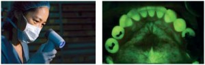 Dr. Catherine Poh uses a flourescence visualization (FV) light tool (L) and normal tissue exposed to light in the blue energy range (FV) appears green, cancerous or precancerouslesions lose flourescence and appear dark brown.